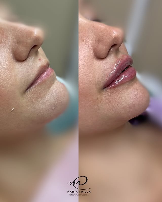 542275442_17993825036831468_1221596679558683457_n.