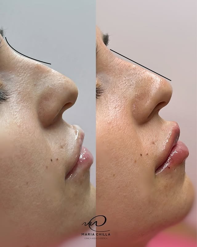 542387340_17994023216831468_4913452819596325081_n.