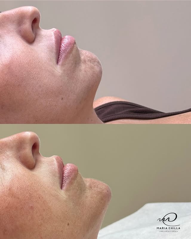 549753002_17995025831831468_7078936373034774999_n.